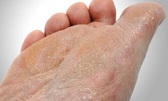 Пътеки за предаване на гъбички на краката