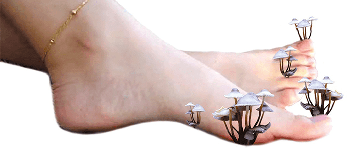 гъбички по краката